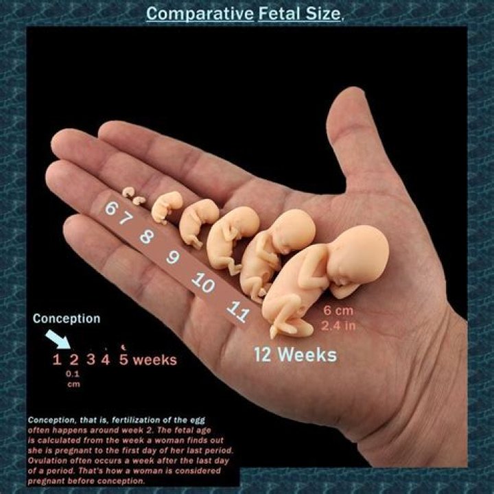 Can you miscarry naturally at 13 weeks?