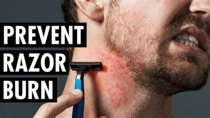 How do you fix razor burn down there?
