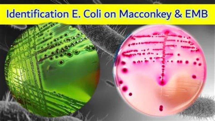 How do you identify Escherichia coli?