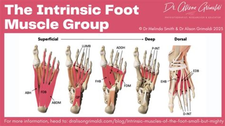 How do you know if you tore a muscle in your foot?