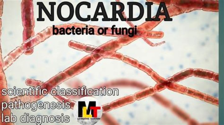 How do you treat nocardiosis?