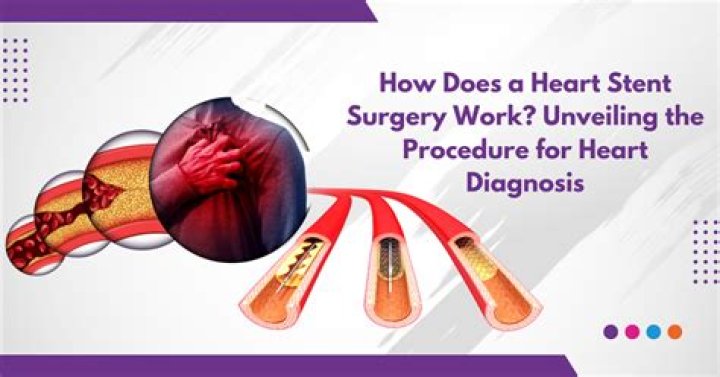 How long does stent graft aneurysm surgery take?