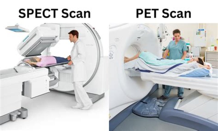 Is MRI better than SPECT?