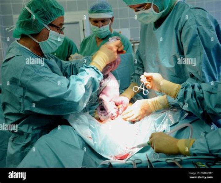 Is natural birth better than C section for baby?
