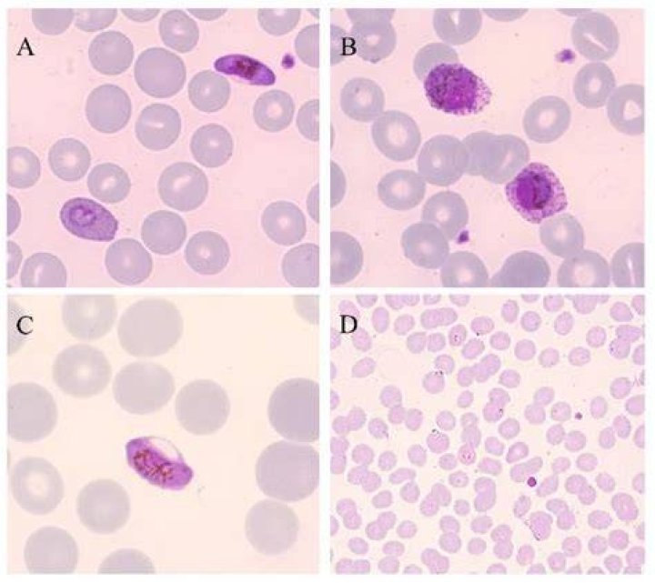 Is Plasmodium falciparum gram positive?