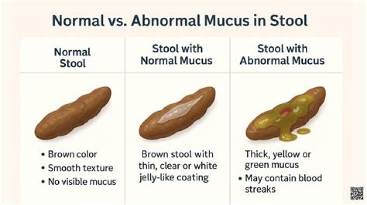 What does Brown mucus from lungs mean?