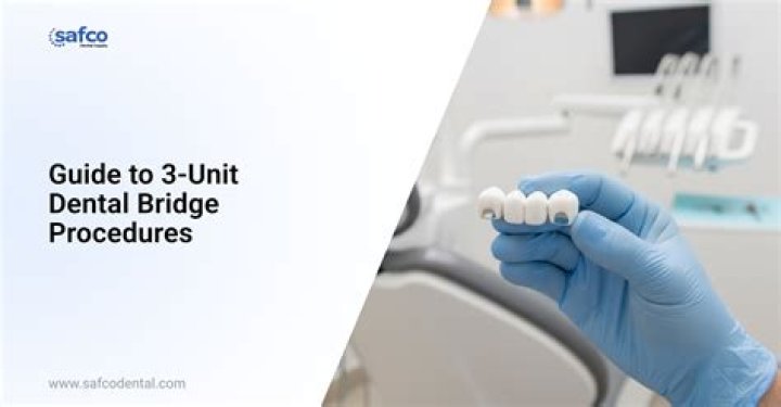 What is a 3 unit bridge?