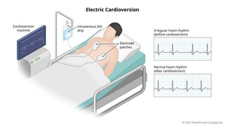 What is DC cardio?