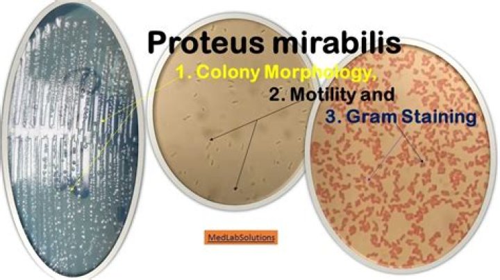 What is the colony morphology of Proteus mirabilis?