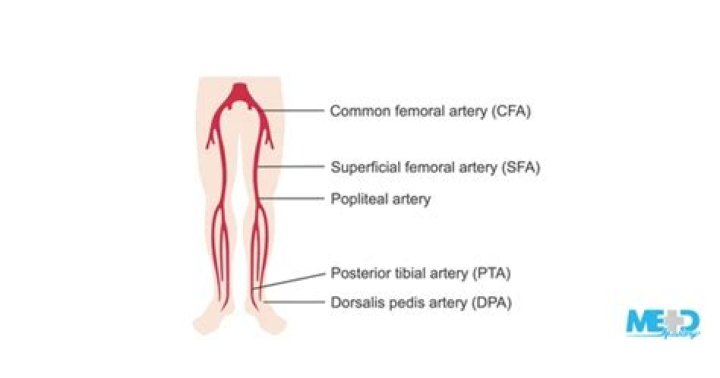 What is the SFA artery?