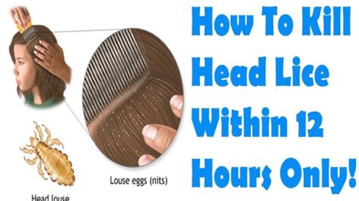 What kills lice immediately?