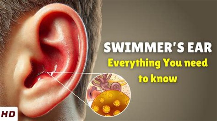 Why is my ear hurting after swimming?